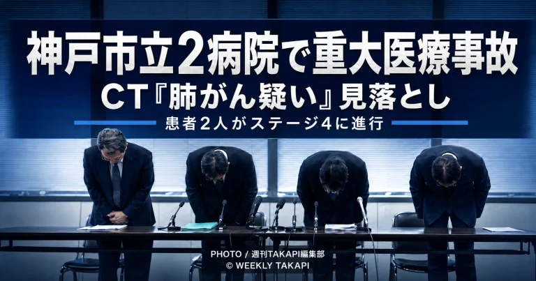 神戸市立医療センター中央市民病院と西市民病院で、CTの画像診断レポートに記載された肺がん疑いを担当医が見落とし、患者2人がステージ4まで進行した医療事故を伝える青系報道アイキャッチ