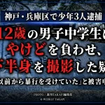 神戸市兵庫区で12歳の男子中学生にやけどを負わせ、下半身を撮影した疑いで少年3人が逮捕された事件を伝える報道イメージ